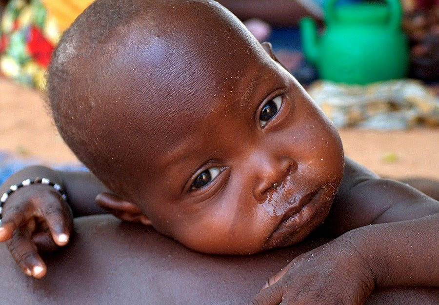 Αφρική: 45 εκ. άνθρωποι λιμοκτονούν για 284 εκ. δολάρια