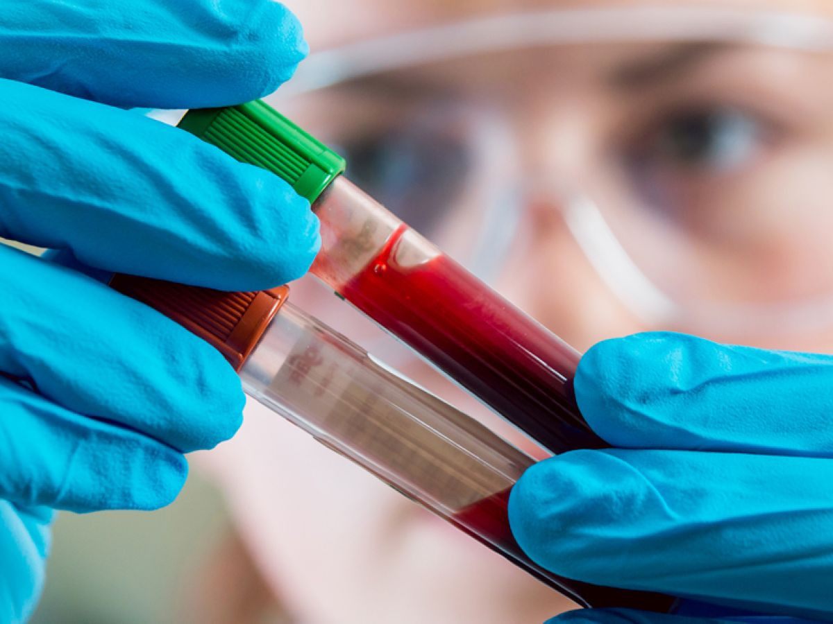 Νέο αιματολογικό τεστ δίνει ελπίδες για την έγκαιρη διάγνωση πολλών καρκίνων ταυτόχρονα