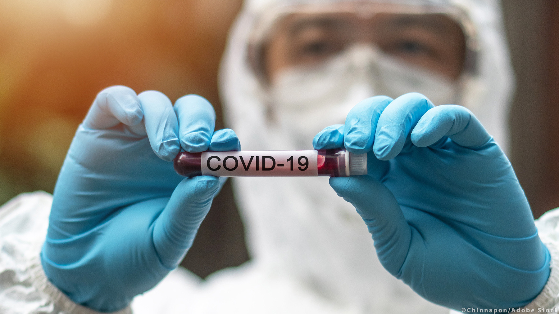 Ελπίδες από τη χορήγηση πλάσματος ιαθέντων από COVID-19