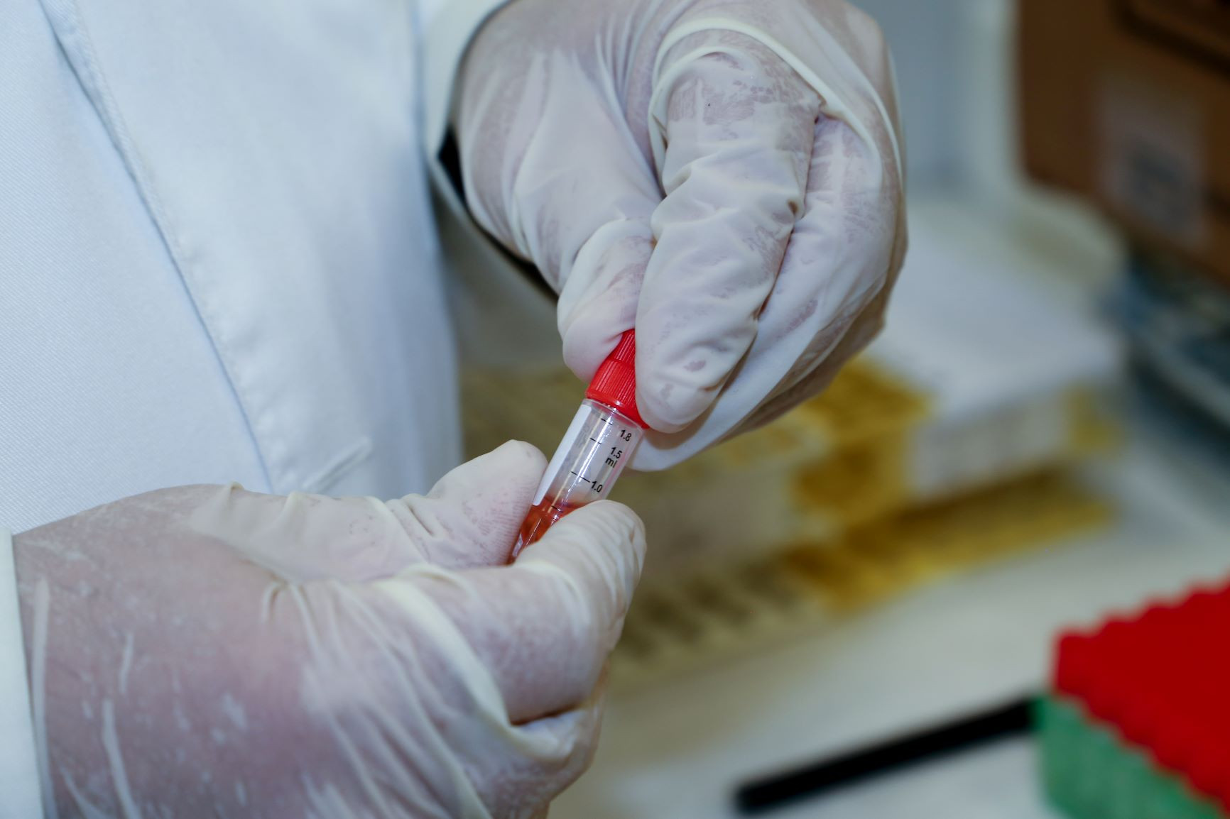 Σύμβαση εργασίας απαιτεί λήψη δειγμάτων σάλιου και αίματος