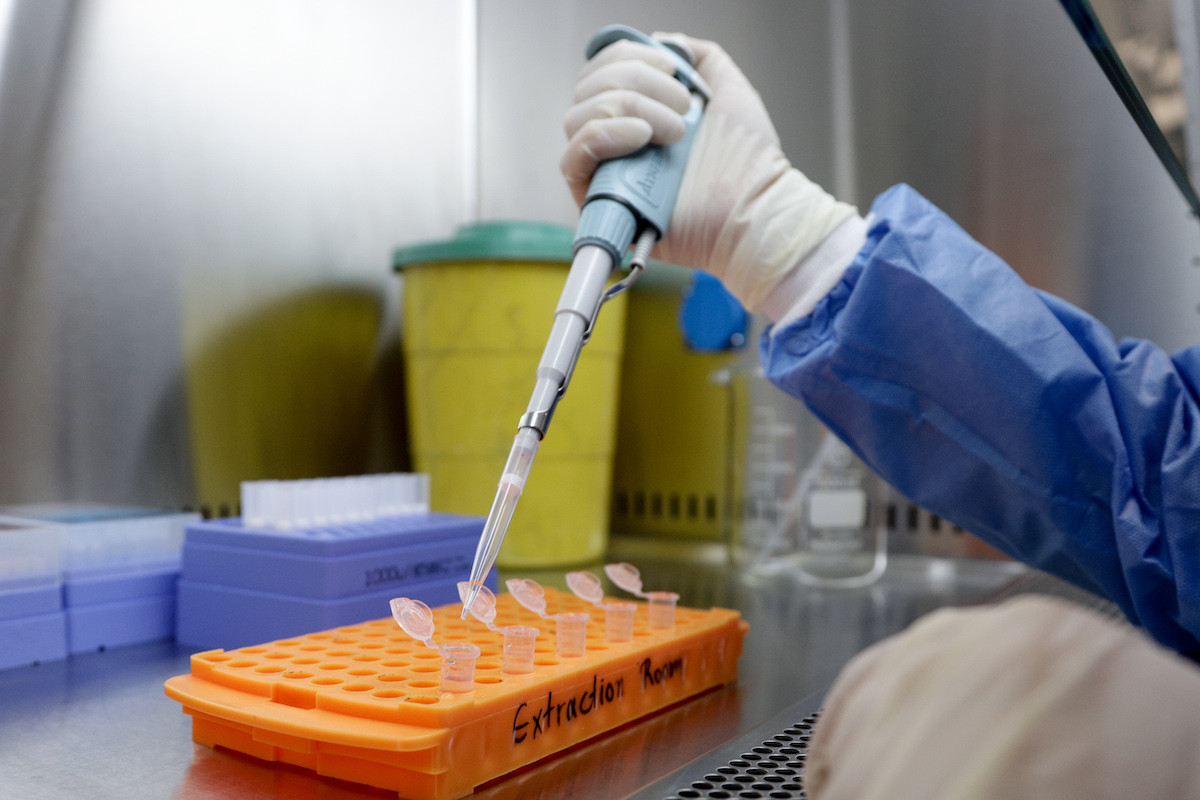 Επιστήμονες: Τα μοριακά τεστ για κοροναϊό πρέπει να αναφέρουν και ιικό φορτίο
