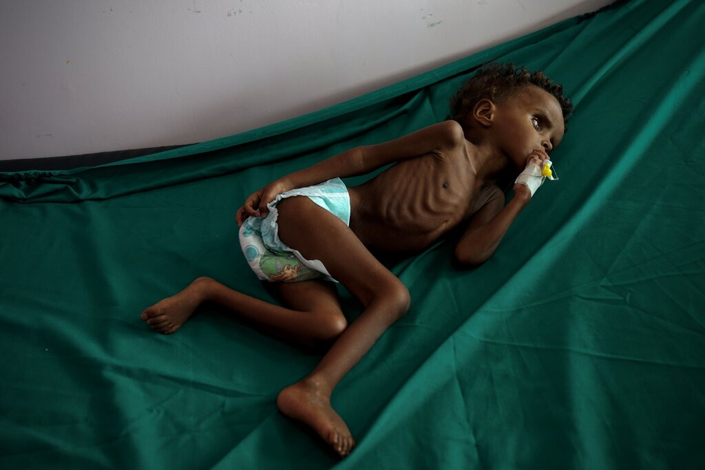 Τα παιδιά που λιμοκτονούν δεν κλαίνε