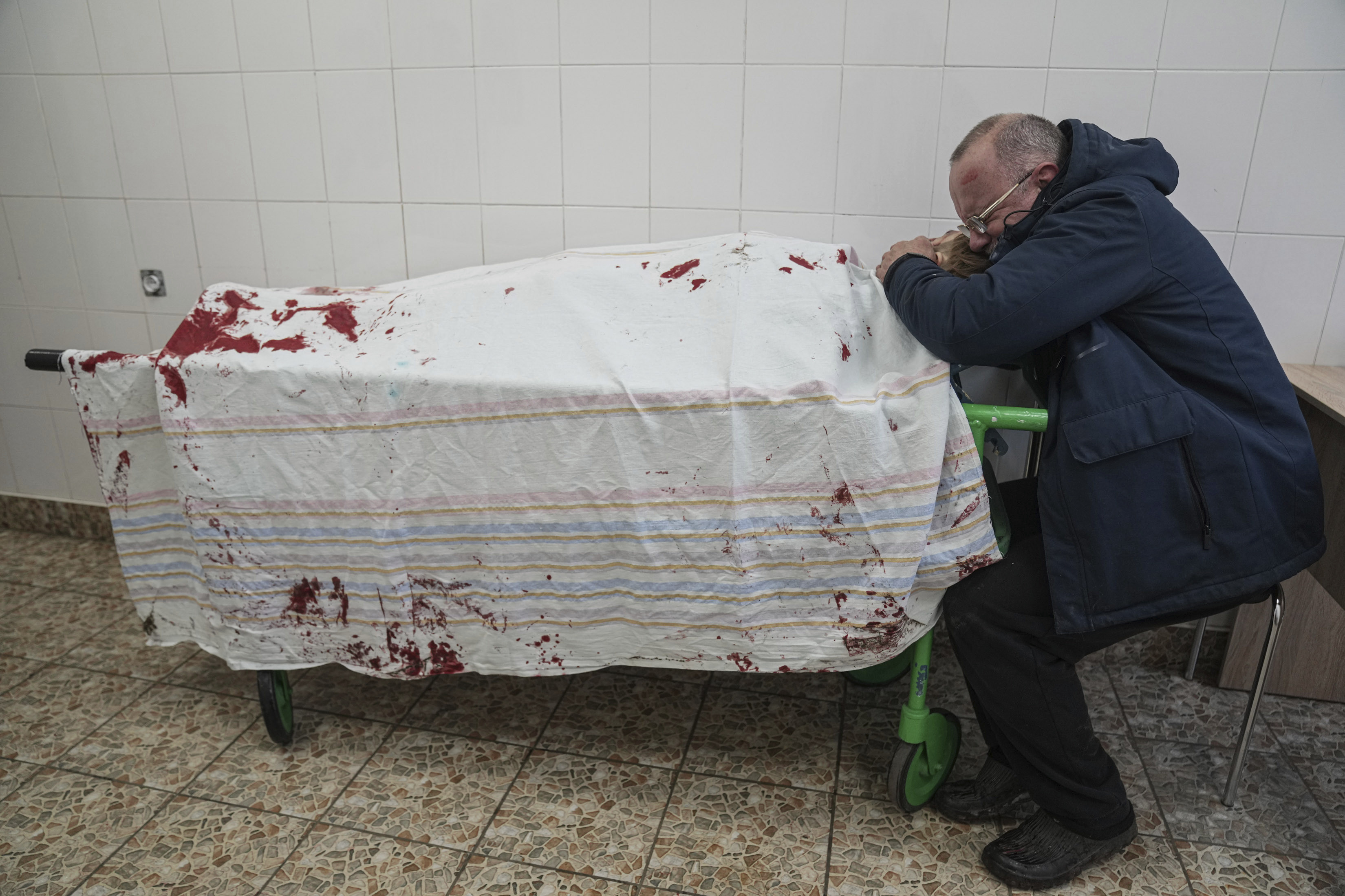 Φωτογραφία του Assosiated Press: Η φρίκη του πολέμου της Ουκρανίας σε μια εικόνα