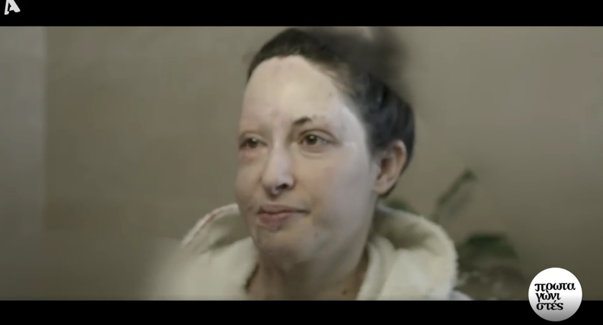 Η Ιωάννα Παλιοσπύρου χωρίς τη μάσκα: «Τους πρώτους μήνες δεν μπορούσα καν να αγγίξω τον εαυτό μου» [Βίντεο]