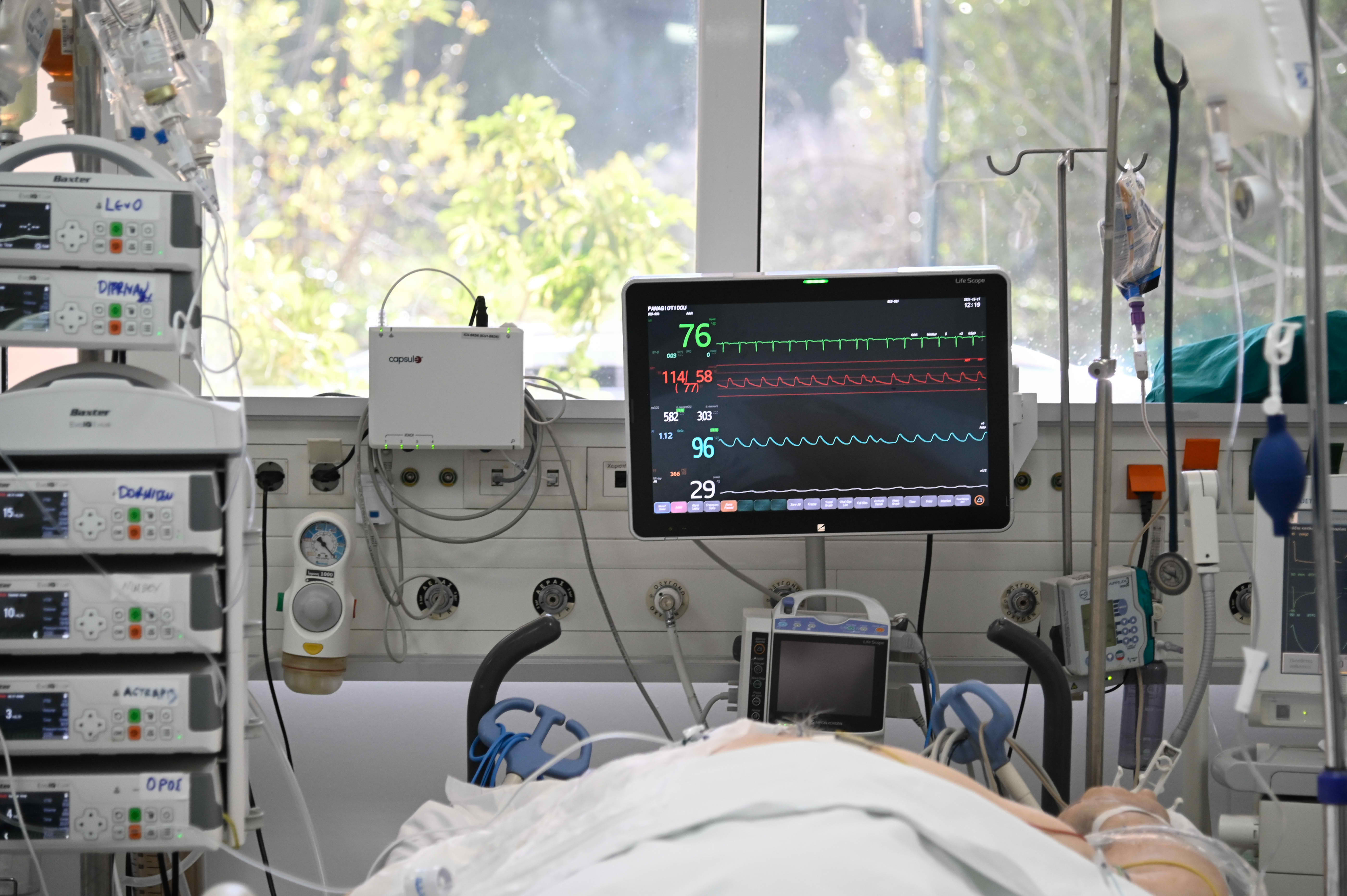 Ερώτηση Βαρεμένου για θνητότητα 100% στην ΜΕΘ του νοσοκομείου Αγρινίου – Έκθετο άφησε η Γκάγκα τον Πλεύρη