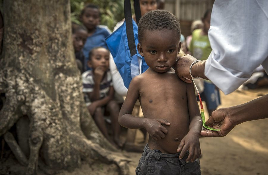 UNICEF: 8 εκατομμύρια παιδιά κινδυνεύουν να πεθάνουν λόγω υποσιτισμού