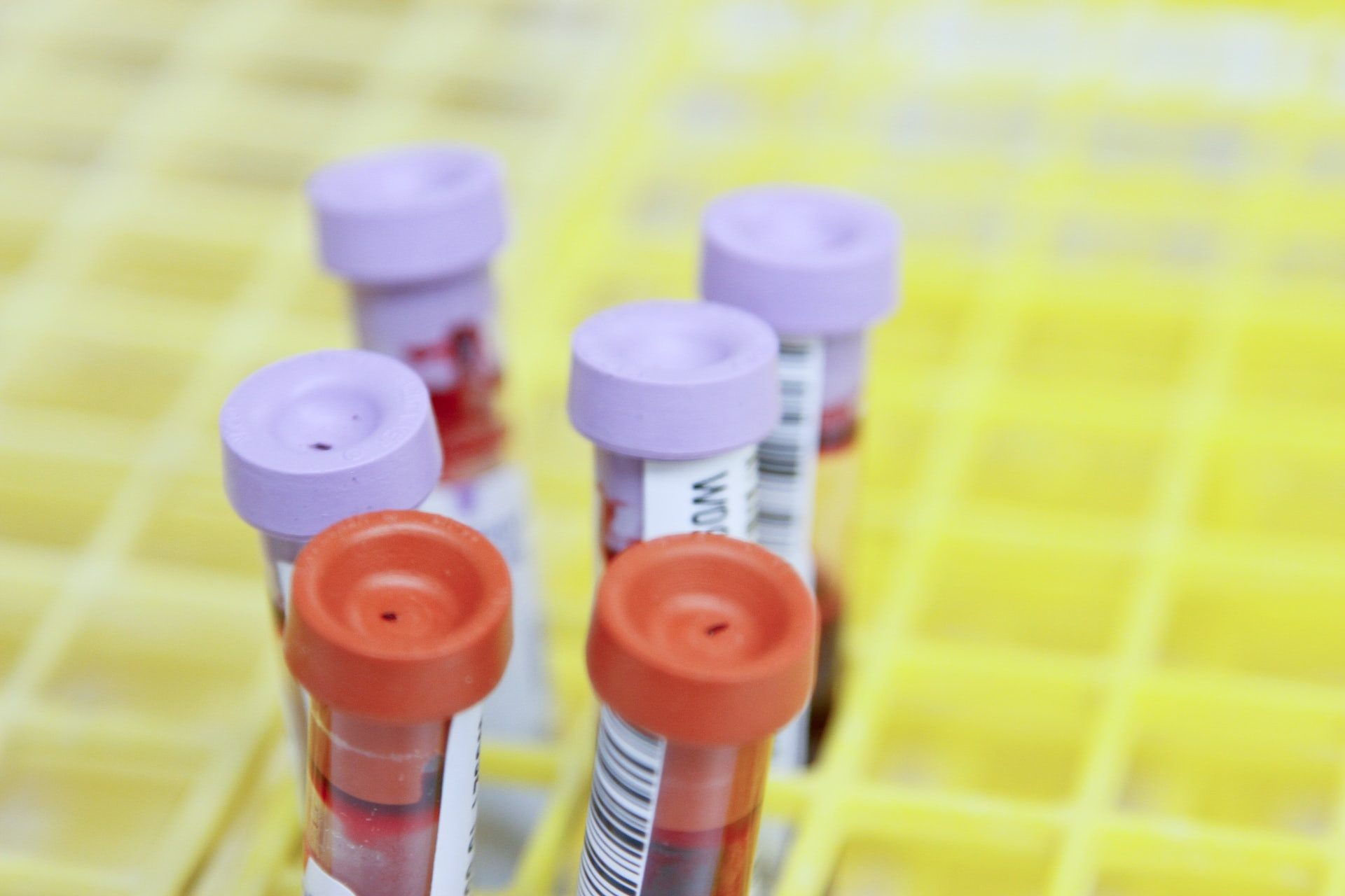 Στα σκαριά το πρώτο τεστ αίματος που θα μπορεί να προβλέψει ποιος κινδυνεύει από long covid