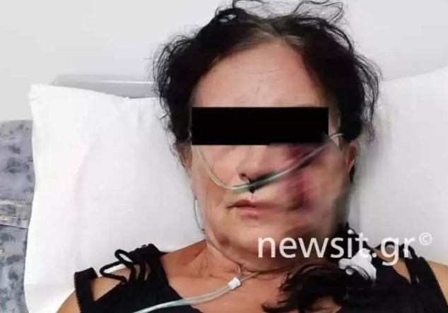 Αίγινα: Άγρια επίθεση σε 67χρονη και τον γιο της μετά από καταγγελία κατά νυχτερινού κέντρου [Φωτογραφίες]