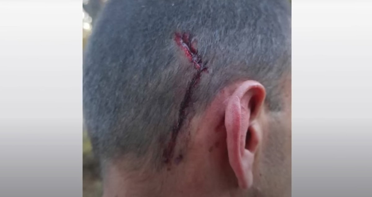 Τραυματίστηκε πρόσφυγας μετά από πυροβολισμούς στα σύνορα Τουρκίας – Βουλγαρίας