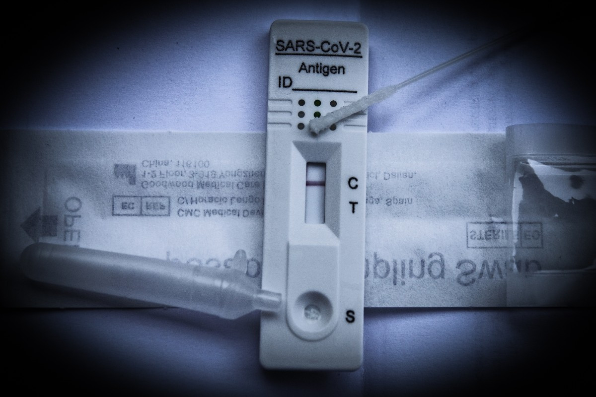 Ακριβαίνουν self test, rapid test και PCR – Η εγκύκλιος της ΑΑΔΕ