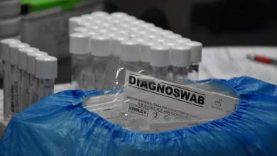 viopathologoi-i-methodos-pooling-toy-idiotikoy-ergastirioy-mporei-na-ayxisei-ton-kindyno-exaplosis-toy-koronaioy-0